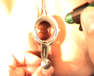 Gynéco pervers baise avec sa grosse cliente Gynéco pervers baise avec sa grosse cliente